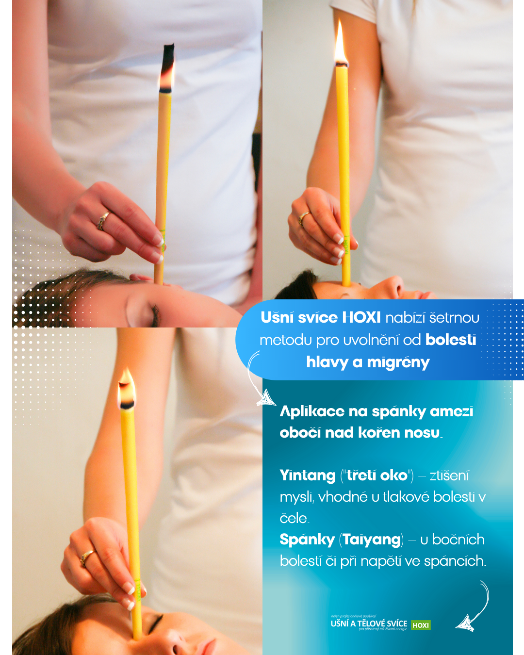 Aplikace tělové svíce HOXI na bolest HLAVY a MIGRÉNU – ukázka aplikace svíce